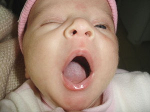 baby yawning